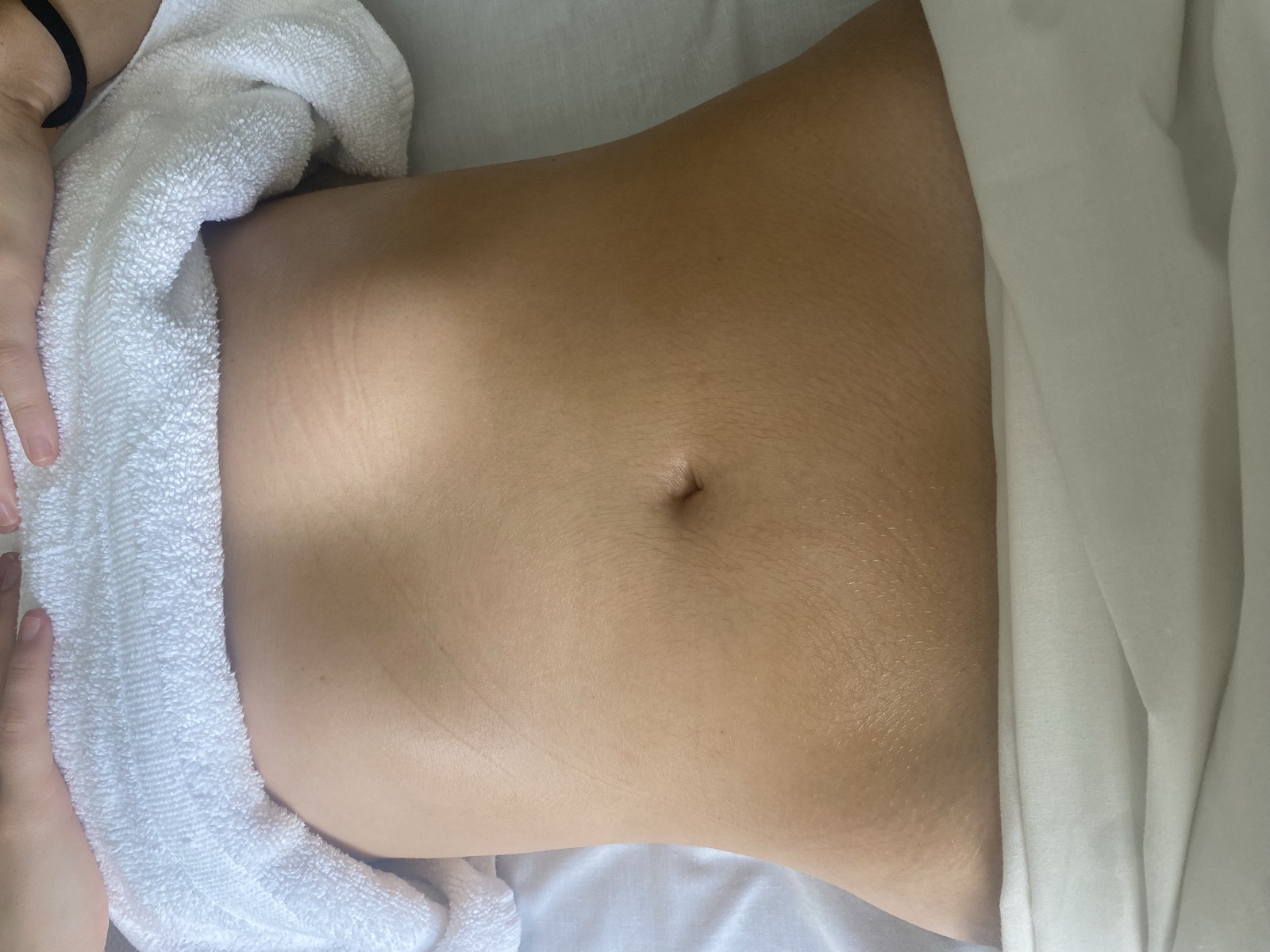 A client's abdomen before a lymphatic drainage treatment at Floatwell Cambridge